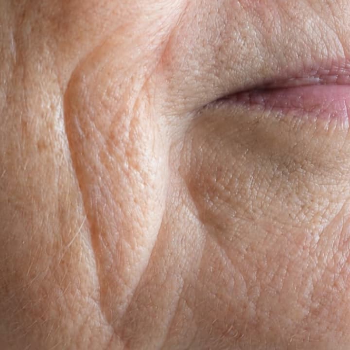 image comparison after